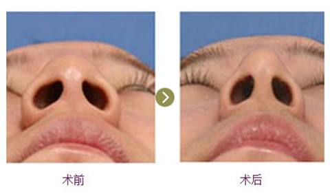 縮小.jpg