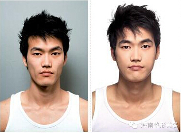 面部填充.jpg