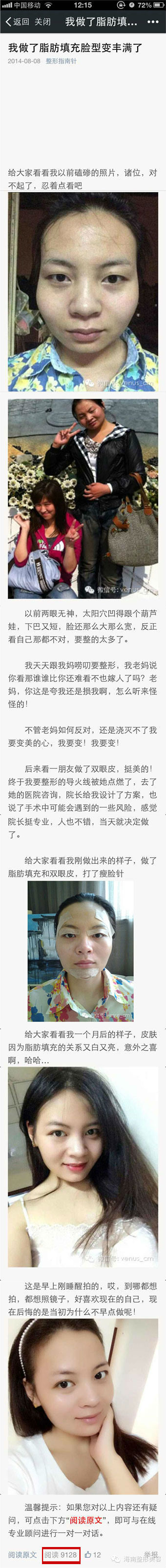 林蔚茜士整形案例.jpg