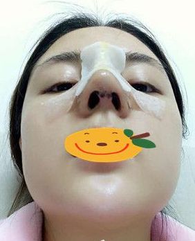 鼻綜合.jpg