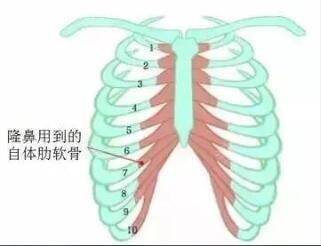 肋軟骨.jpg