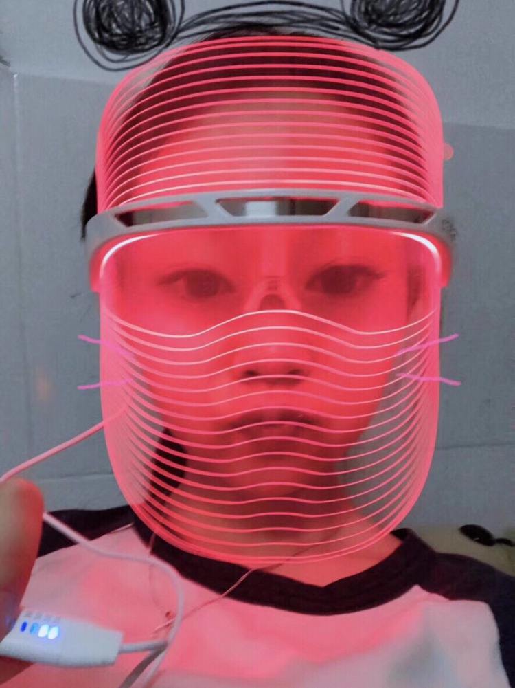 光子嫩膚.jpg