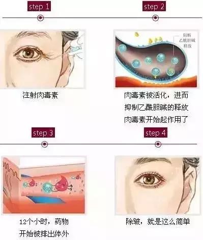 玻尿酸.jpg