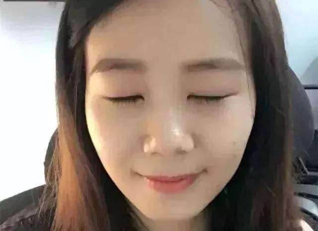 下垂手術(shù).jpg