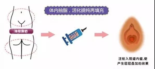 私密抗衰.jpg